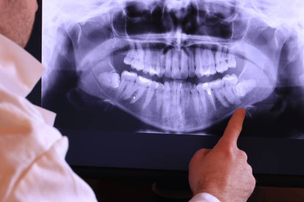 Best Mobile Emergency Dentist in Summitville, IN